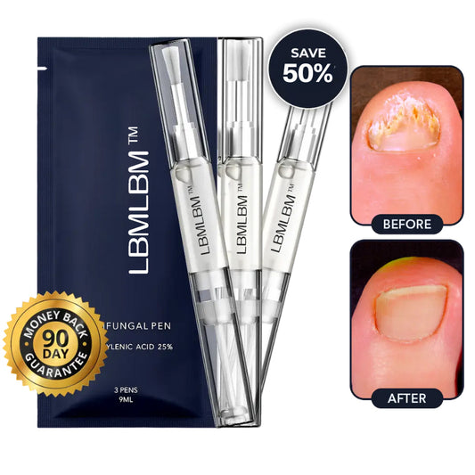 LBMLBM™ Antifungal Pen-UNDECYLENIC ACID25%-Cures Most Athlete's Foot, Jock ltch, andRingworm