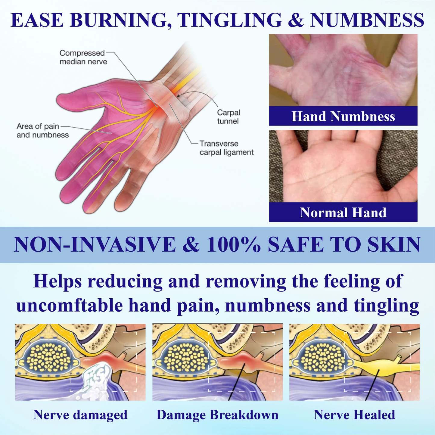 ODALIT™ NumbAway CoolEase Neuropathy Spray