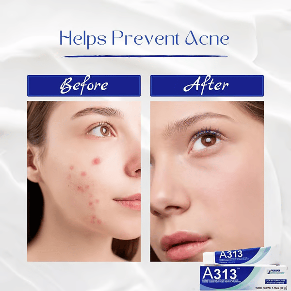 🌿💧A313 + Ialuset Duo – Collagen-Boosting Retinol + Deep-Hydrating Hyaluronic Acid for Smooth, Youthful Skin