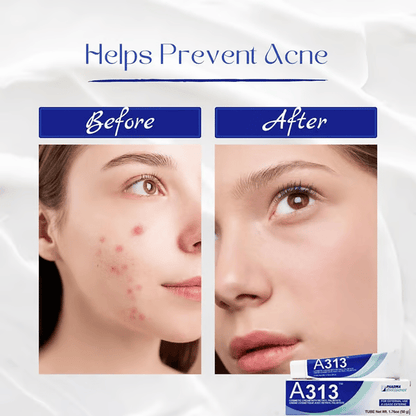 🌿💧A313 + Ialuset Duo – Collagen-Boosting Retinol + Deep-Hydrating Hyaluronic Acid for Smooth, Youthful Skin