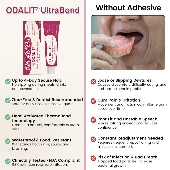 ODALIT® UltraBond Premium Denture Adhesive 🔥(Clinically Proven 4-Day Hold for Secure, Comfortable & Zinc-Free Denture Fit 🦷)