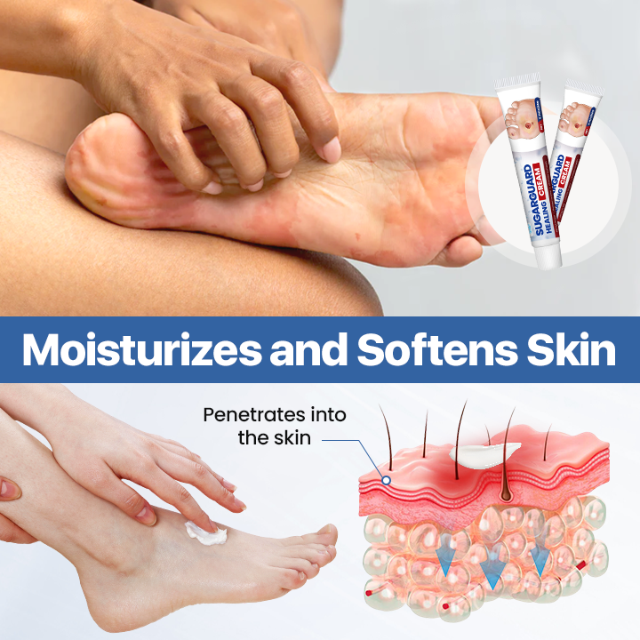 JEREMYTIS® SugarCare Healing Lotion