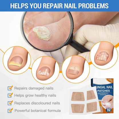 ✅Toenail Fungus Treatment Extra Strength - 21 Nighttime Hydrogel Patches for Overnight Toenail Repair🏥
